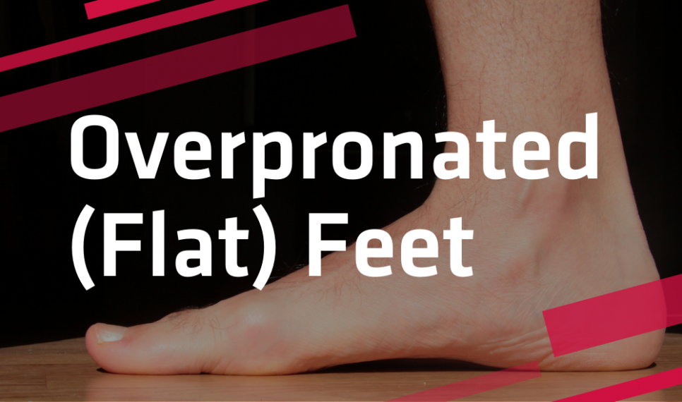 Flat clearance pronated feet